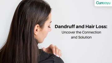 dandruff and hair loss