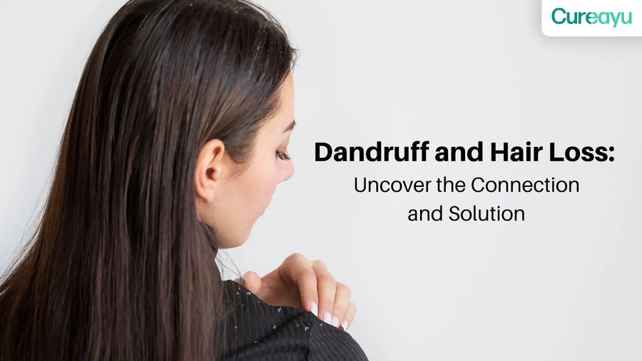 dandruff and hair loss