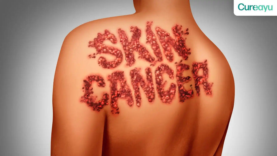 skin cancer symptoms