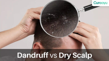 dandruff vs dry scalp