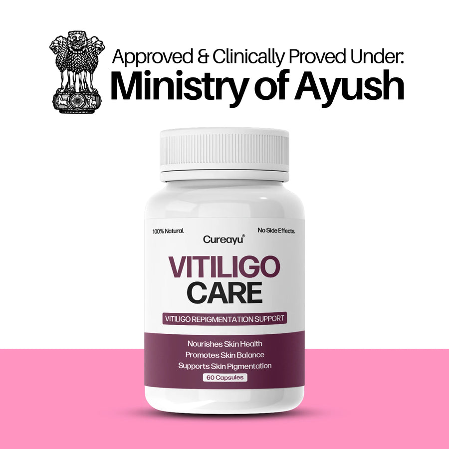 Vitiligo Care Capsules