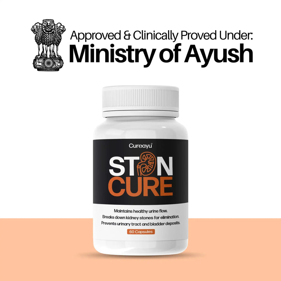 Stoncure Capsules