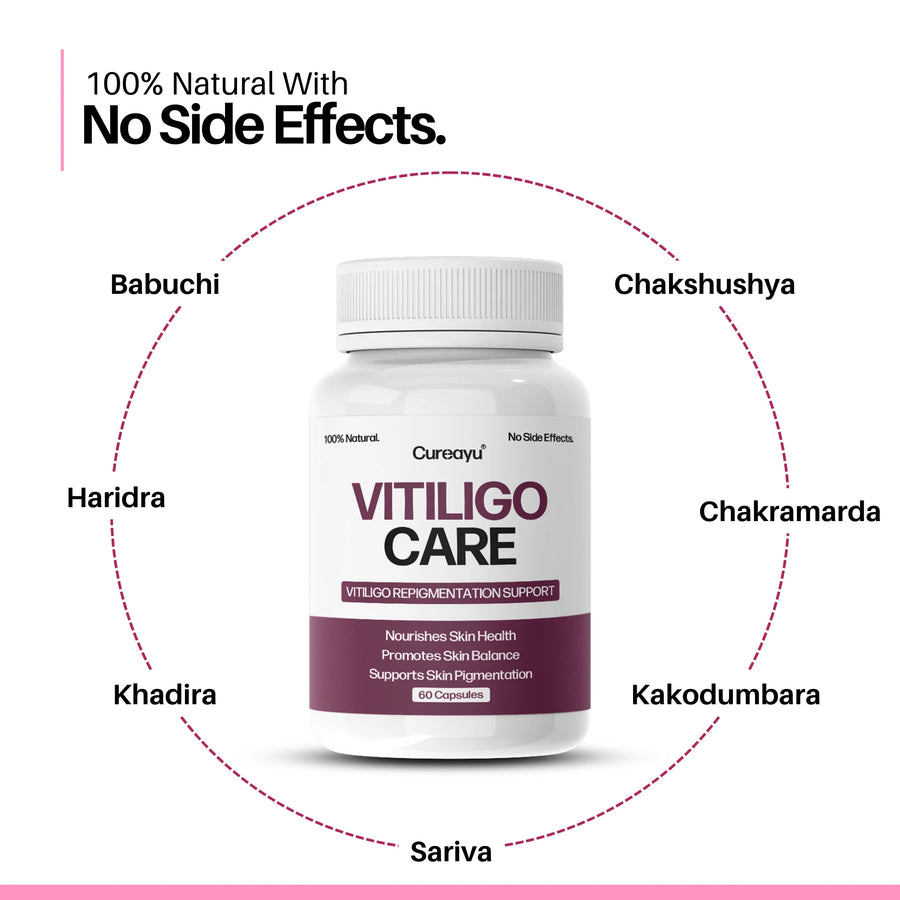 Vitiligo Care Capsules