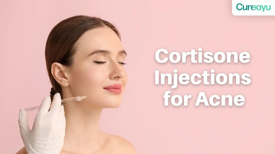 cortisone injection acne