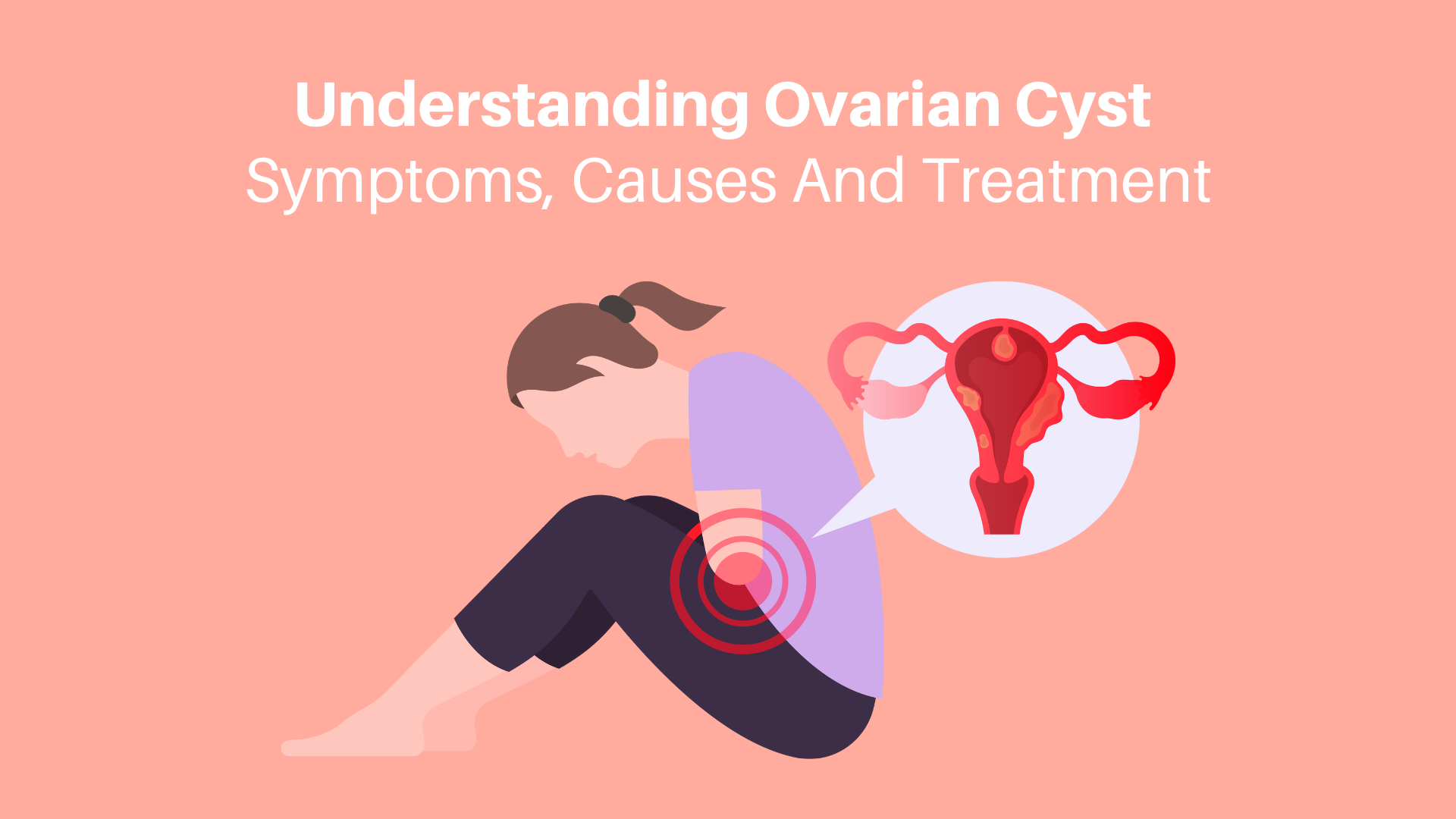 Understanding Ovarian Cyst Symptoms: A Comprehensive Guide
