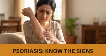 Psoriasis: Symptoms, Triggers & Gentle Ayurvedic Skin Care