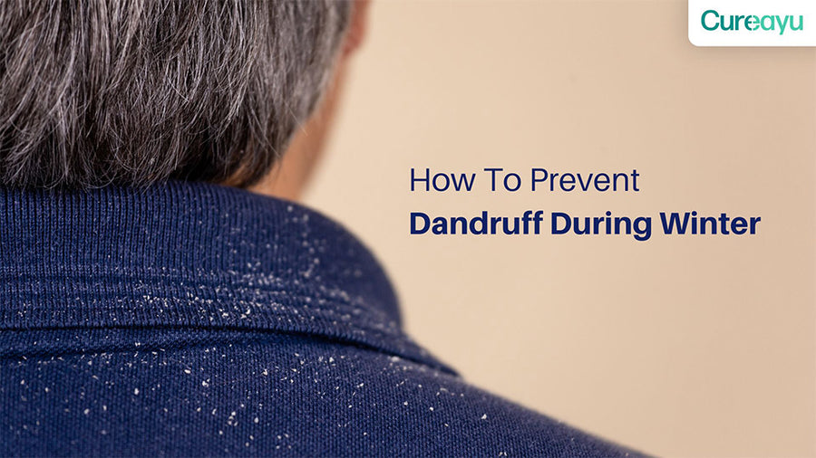 how to prevent dandruff during winter