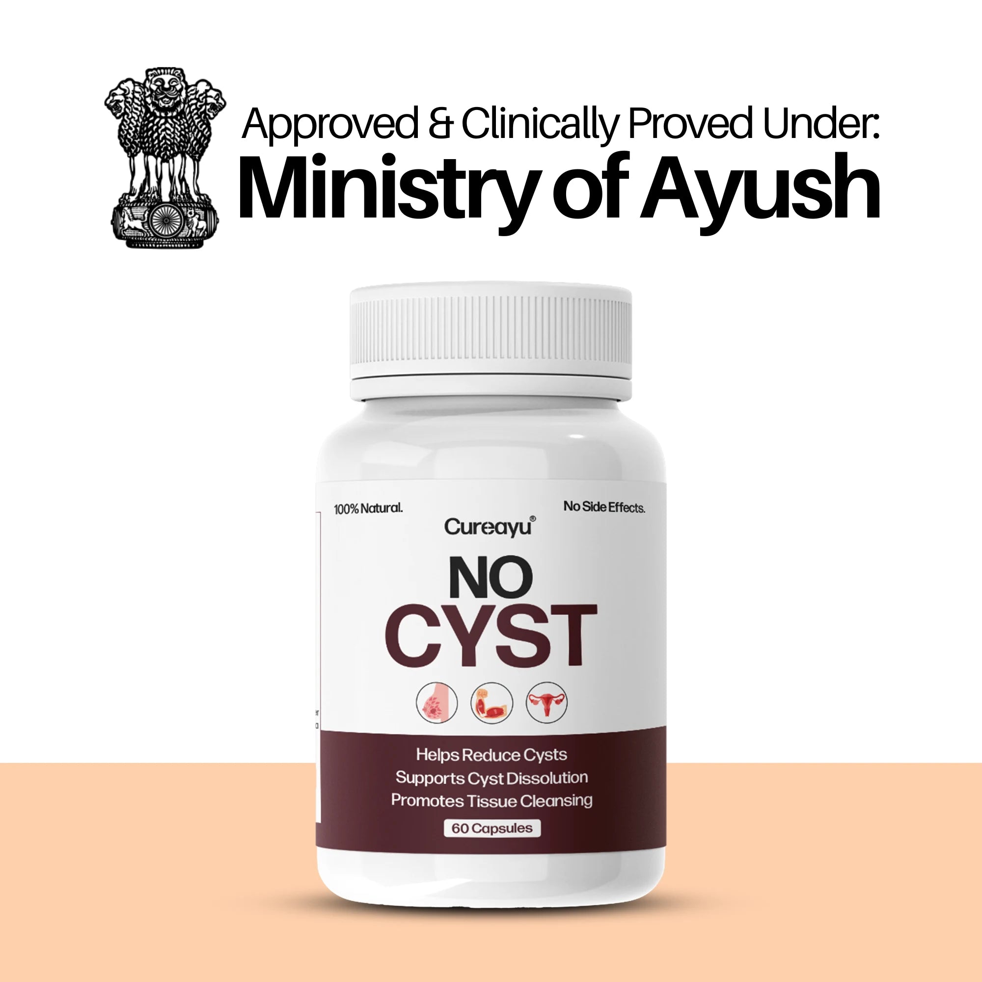 Cureayu No Cyst Capsules | Ayurvedic Support for Cyst Care & Tissue Health