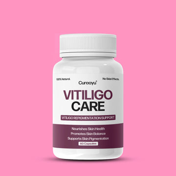 Cureayu Vitiligo Care Capsules | Ayurvedic Support for Skin Pigmentation & White Patches