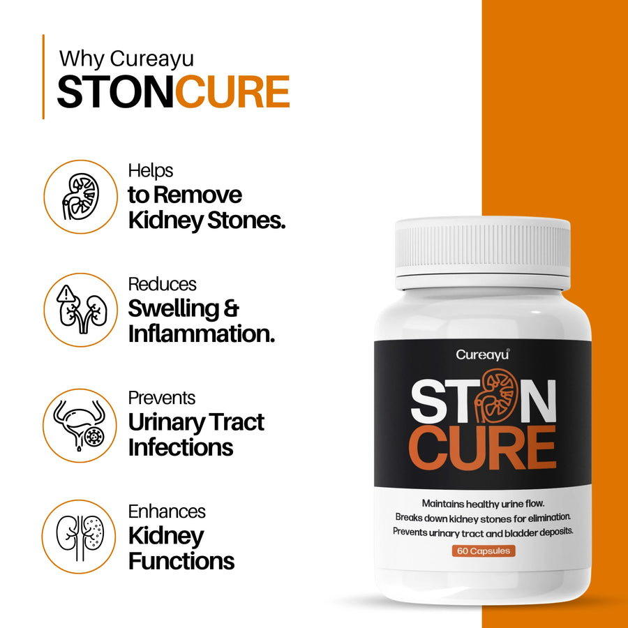 Stoncure Capsules