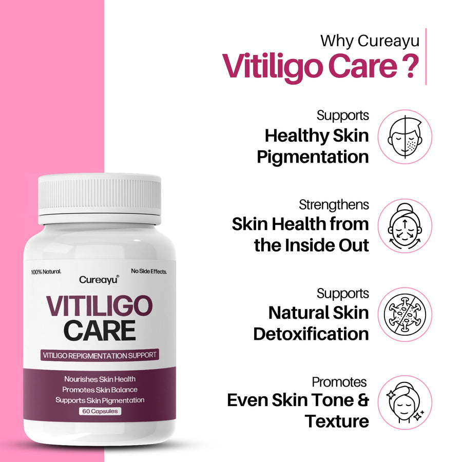 Vitiligo Care Capsules